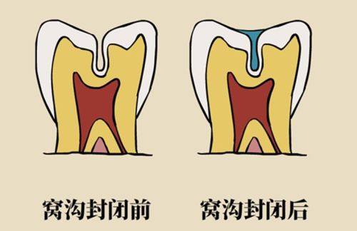 福州金福康口腔诊所擅长项目: