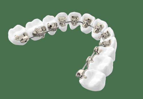 曾堃医生技术优势