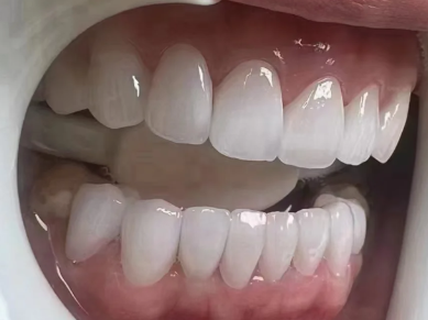 耒阳雅贝康口腔(五梅路店)口碑评价: