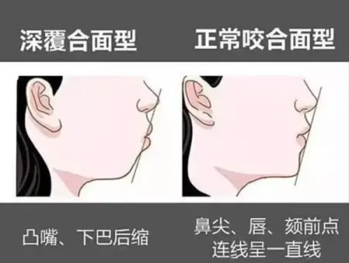 四、医生定制方案：复杂地包天的良好解