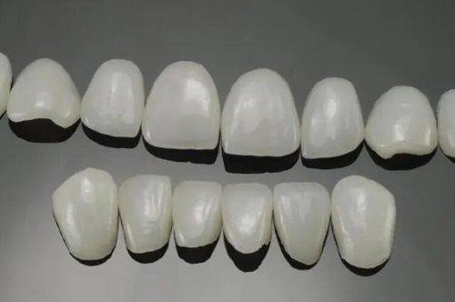 五、拔完牙后，如何判断自己适合哪种种牙时机？