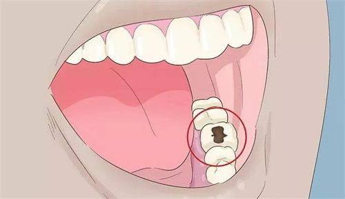 青海西宁姚慧钧口腔诊所擅长项目: