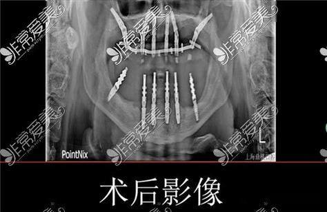 临汾侯马经济开发区松阳口腔诊所价格表