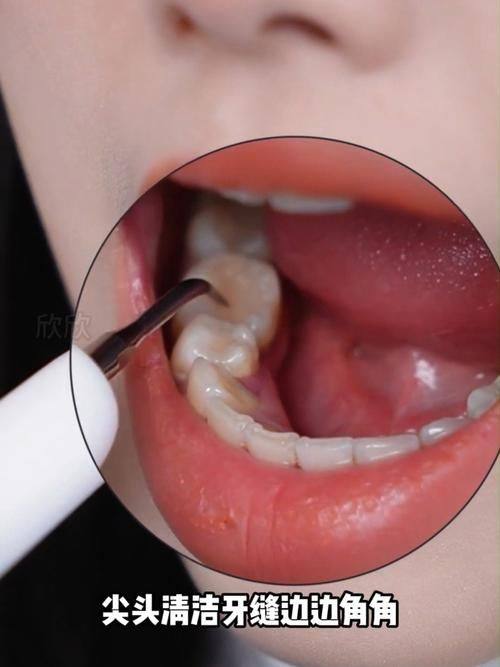 青海西宁姚慧钧口腔诊所预约挂号方式: