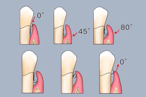 株洲乐莎莎口腔预约挂号方式