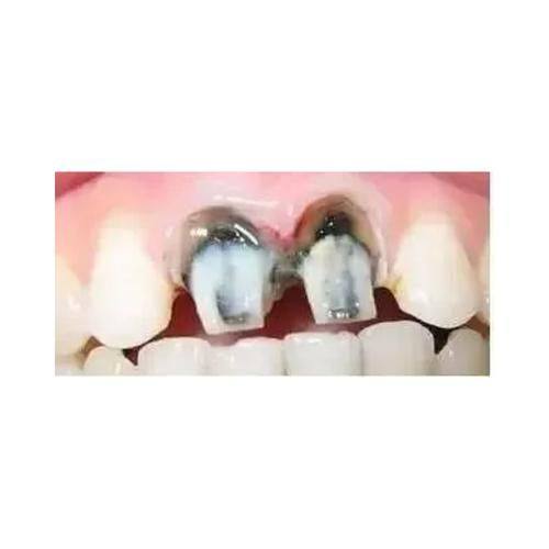 思明港悦齿科口腔门诊部擅长项目：