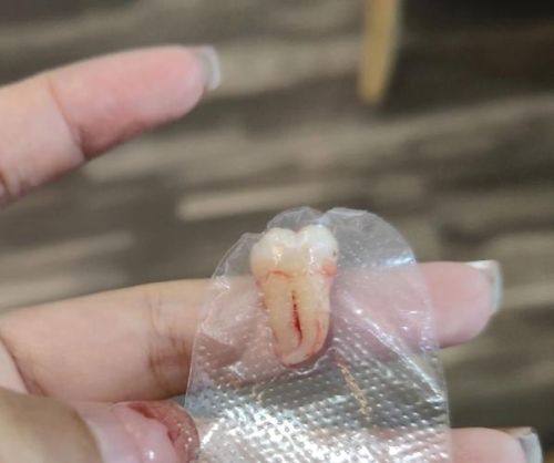 思明港悦齿科口腔门诊部价格表：