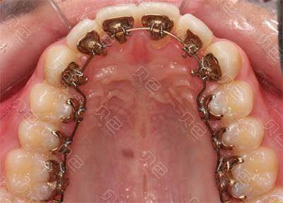 上海金浩雅口腔价格表