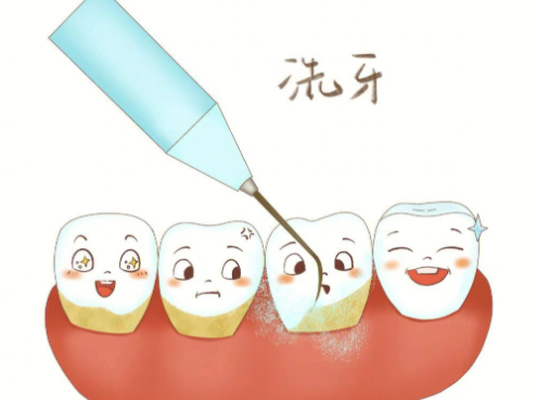 四、种牙在拔牙后什么时间种至佳？按需选择才是关键