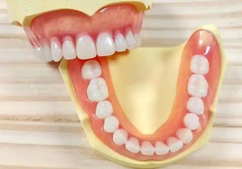 五、即拔即种VS延期种植:如何做出适合自己的选择?