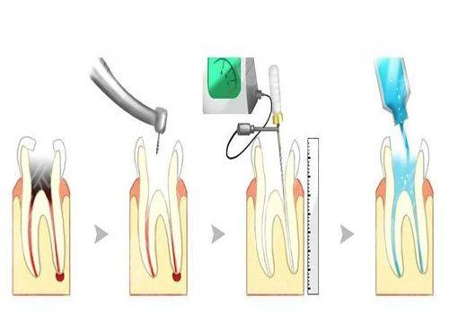 韶关古德口腔擅长项目：