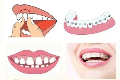 新疆瑞恩宝口腔医生名单及擅长领域