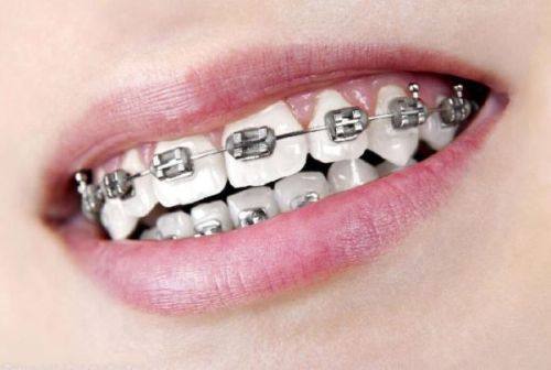 70岁的老人种植牙好吗？条件达标是优质选择 含价格/适配条件/风险解析