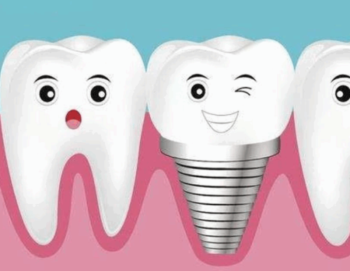 三、全瓷牙与烤瓷牙的对比：为什么说更差的全瓷牙都比烤瓷牙好？