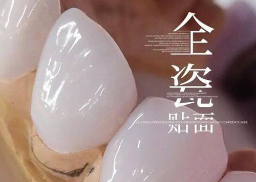 六、2025年半口种植牙全新价格参考