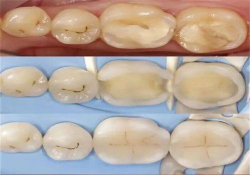 新疆瑞恩宝口腔擅长项目