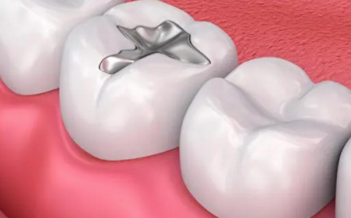 福建泉州丰泽奥乐口腔价格表：