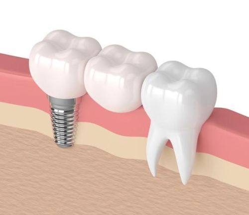 徐影医生口碑评价