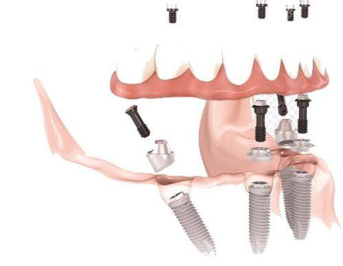 雅安市万登权口腔诊所口碑评价