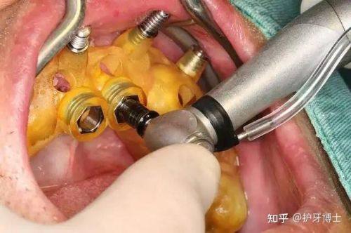 雅安市万登权口腔诊所地址电话及营业时间