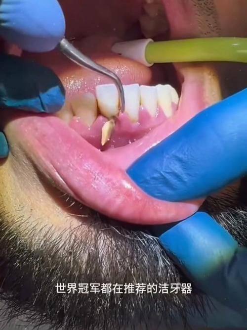 雅安市万登权口腔诊所擅长项目：