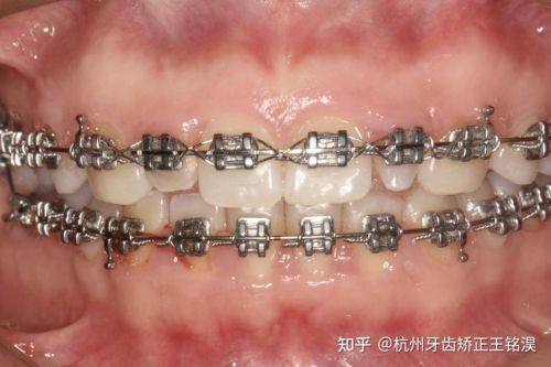 雅安市万登权口腔诊所预约挂号方式