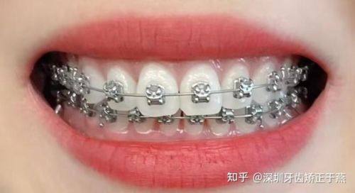 北京口腔工作者协会丰台第二门诊部擅长项目：