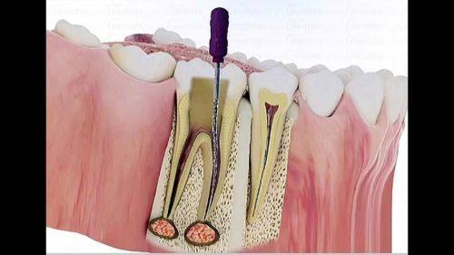 胡馨方医生口碑评价: