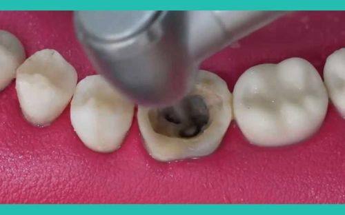 北京壹加壹口腔口碑评价：