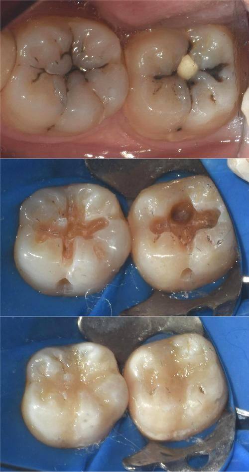 北京口腔工作者协会丰台第二门诊部价格表：