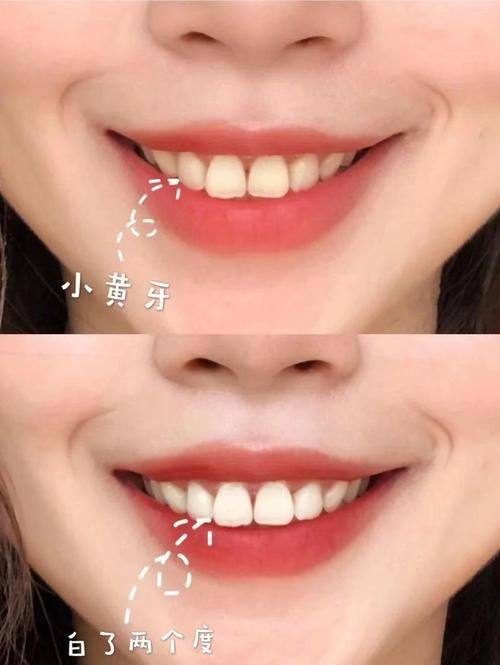 佳桦欧芽拜尔口腔门诊部(龙华店)预约挂号方式