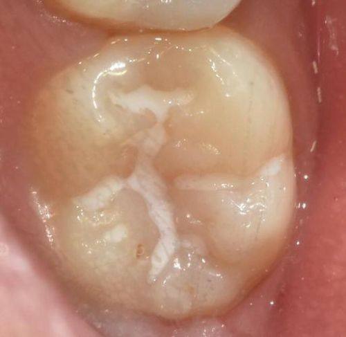 中卫至美口腔诊所地址电话及营业时间