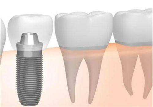 南京浦口民德中医和西医结合门诊(口腔科)价格表