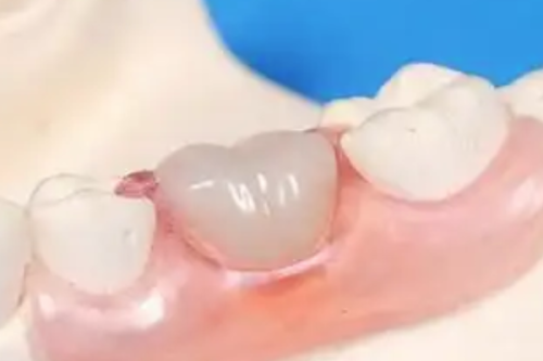 广州暨穗正合口腔(敦和店)擅长项目