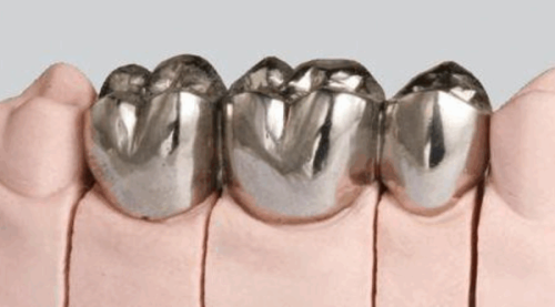 四、9岁小孩补牙后的注意事项，助力恒牙健康发育