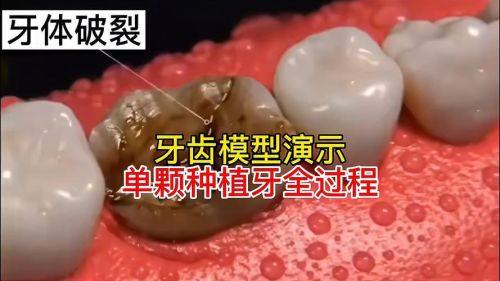 徐影医生擅长领域