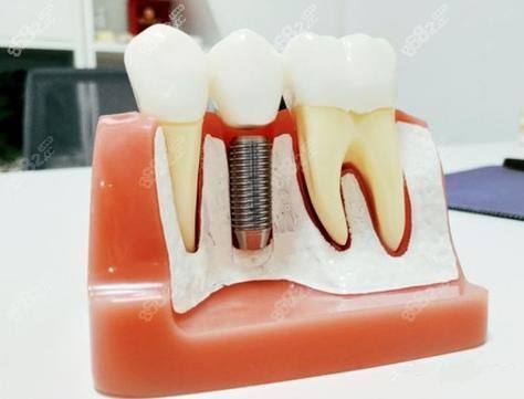 浙江绍兴柯桥维恩口腔门诊部预约挂号方式