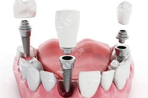 赵策医生怎么预约