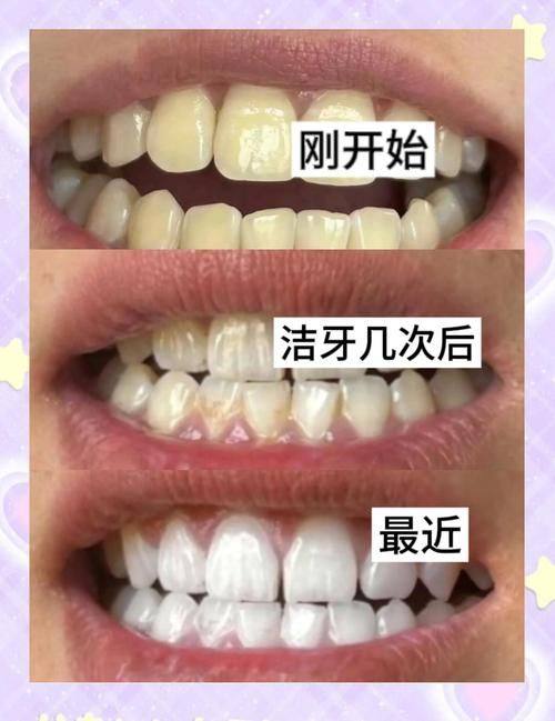 重庆沙坪坝段金亮口腔口碑评价