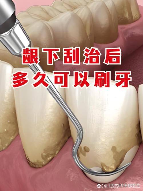 重庆酉阳开口笑牙科价格表