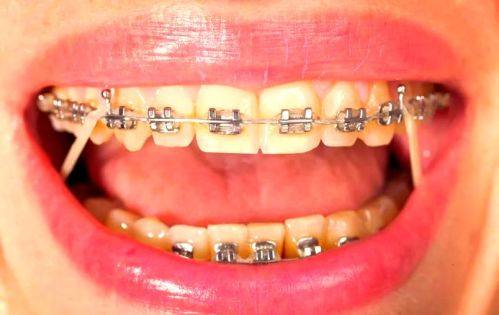 浙江杭州淳安唐巧先口腔地址电话及营业时间：