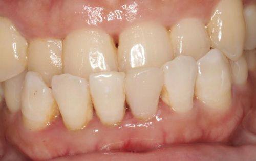 广州暨穗正合口腔(敦和店)预约挂号方式