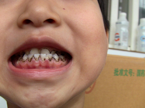 重庆酉阳开口笑牙科擅长项目