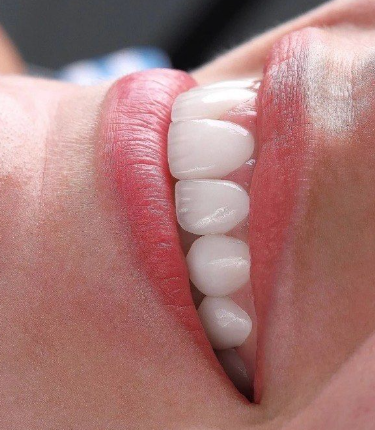 四、生理期拔牙的风险后果与危害