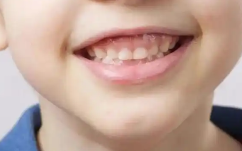 六、特殊情况的饮食调整与风险提示