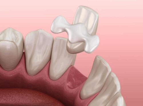 三、11岁男孩洗牙会有影响吗