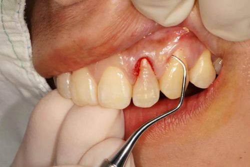 孙海燕医生技术优势