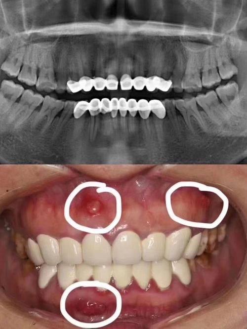 山西省人民医院口腔修复科地址电话及营业时间