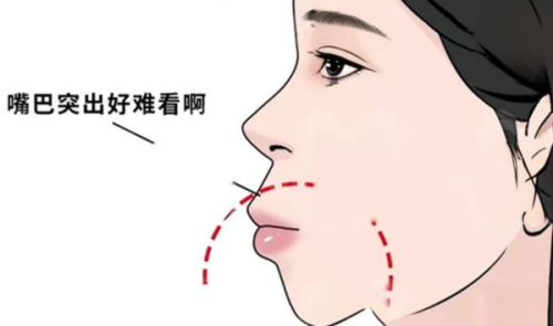 五、为什么口腔诊疗会建议生理期结束后3-7天拔牙