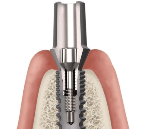 六、生理期突发牙疼该如何应对，而非强行拔牙